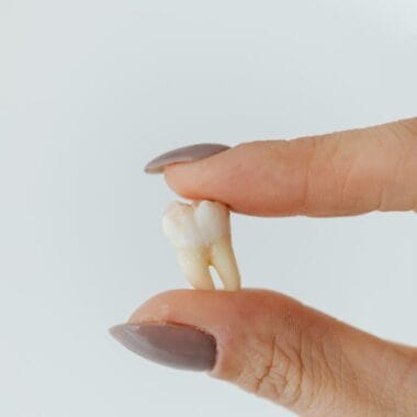 What to Eat After Wisdom Tooth Removal? Best Foods for Quick Healing