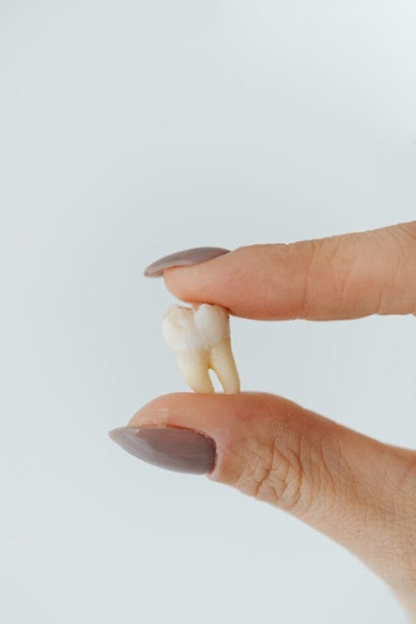 What to Eat After Wisdom Tooth Removal? Best Foods for Quick Healing 1 wisdom tooth removal